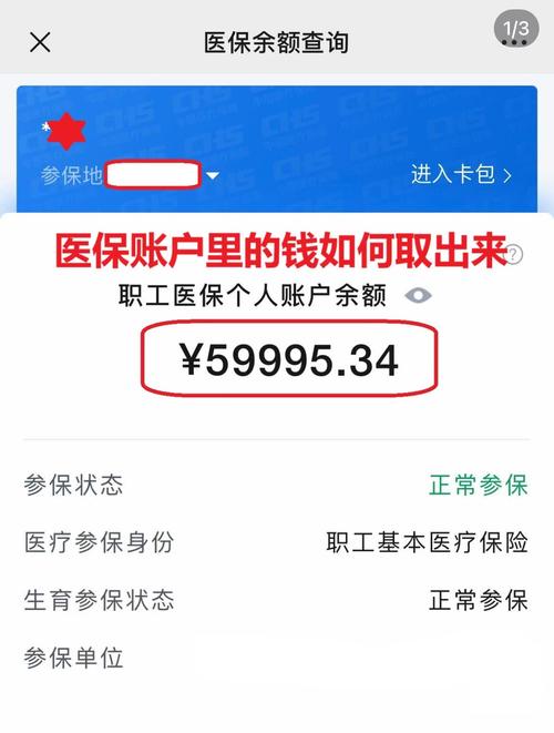 荣和医保在线提取新政策解读：你的医保余额真的能随时变现吗？